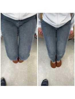 はるかぜ療術院/太もも ・下半身ダイエット！