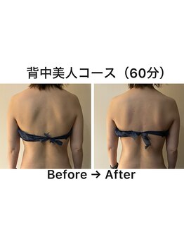 ルース(Luce)/《背中美人コース》