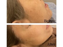 ふうき堂/お客様のビフォーアフター