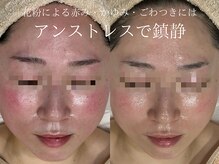 ラシュール(Rassure)/UNSTRESS／アンストレス