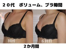 バストサロン メルベイユ(Merveile)/デコルテからボリュームUP