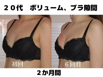 バストサロン メルベイユ(Merveile)/デコルテからボリュームUP