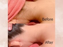 ハナ チュチュ(Hana chuchu)/気になる部分を集中ケア♪