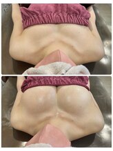 ロココ 豊田店(Rococo)/ビフォーアフター