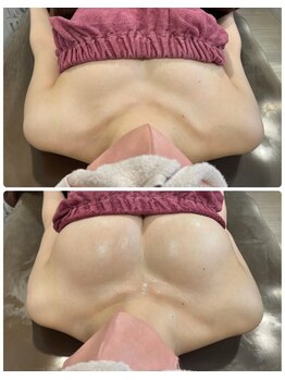 ロココ 豊田店(Rococo)/ビフォーアフター