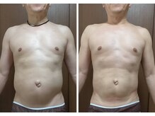 痩身 脱毛専門サロン 椿の雰囲気（メンズ痩身ダイエット！脂肪冷却／キャビテーション／脂肪分解）