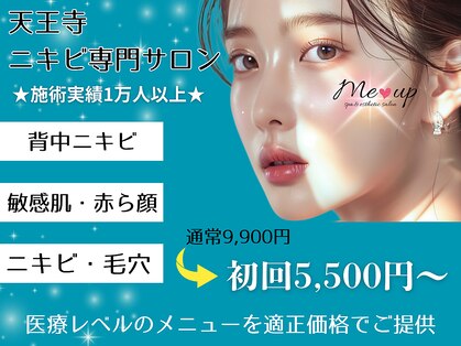 ミーアップ(Me up)の写真