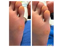 ケア歴20年以上のスタッフ対応！施術後効果実感の声多数◎