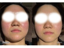 アネル 新都心店(anel)/