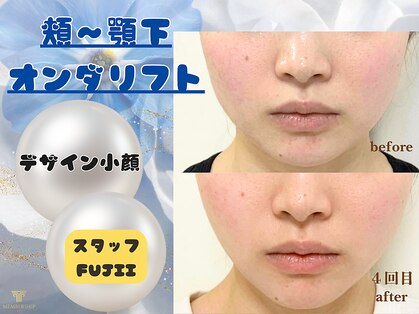クロエビューティー 麻布十番店(クロエbeauty)の写真