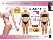 ベルフィーヌボーテ(BELFINE beaute)