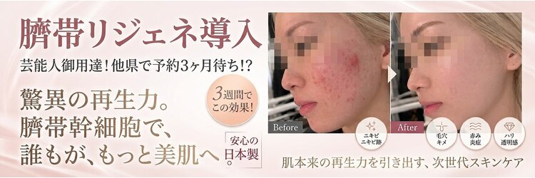 エステティック リオン(Rion)のサロンヘッダー