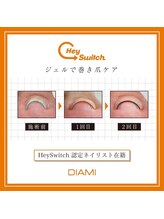 アルテミス(ARTEMIS)/最先端【トラブル爪緩和ケア 】