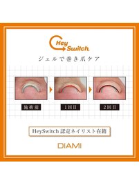 最先端【トラブル爪緩和ケア 】