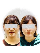 ワカヤマ 小顔(Wakayama)/☆Before・After☆