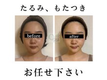 キュープ 名張店(Qpu)の雰囲気（女性のための女性による小顔美容矯正専門店です。）