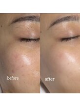 メンテ(MENTE)/さまざまなお肌悩みに