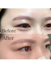 ルイール 光の森(Luire)/えくぱ/熊本/光の森/エクパ