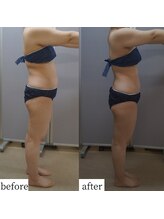 アップルミント/＜痩身＞before・after