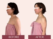 アンリール(Anrire)/【板橋/フェイシャルエステ】