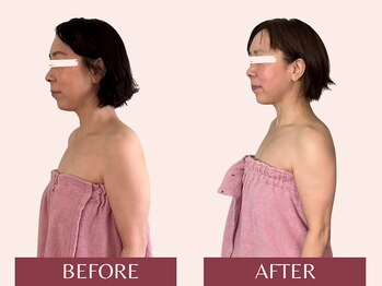 アンリール(Anrire)/【板橋/フェイシャルエステ】