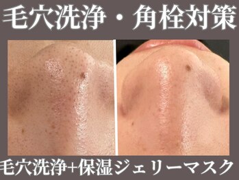 マヴィ 高槻店(MavY.)/毛穴洗浄×高保湿