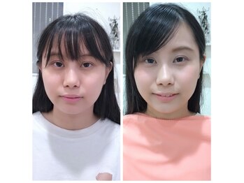 エタニティ(Eternity)