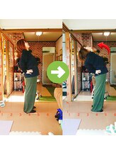 サプライズ整体院/30代ママさんの腰痛初回結果