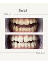 ホワイトニングショップ 福岡姪浜店/