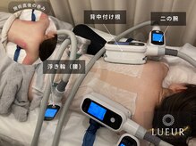 リュール北千住(LUEUR)の雰囲気（【脂肪冷却】背中、二の腕、腰ブライダル６CUPメニューイメージ）