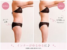 ヨサパーク アカーシャ(YOSA PARK AKASHA)/厚みが気になる方へ