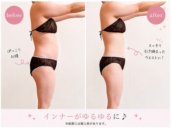 ヨサパーク アカーシャ(YOSA PARK AKASHA)/厚みが気になる方へ