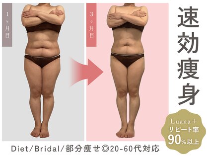 ルアナ プラス(Luana＋)の写真