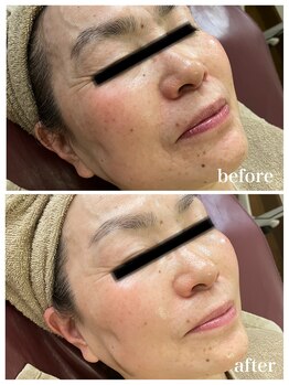 ジャスミン(Jasmin)/エステティック×シェービング