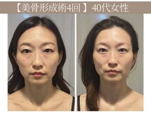 ドクターボディ 恵比寿店(Dr.Body)の雰囲気（【頬のたるみ/目のクマ/頬骨の広がり】解消★ 小顔/恵比寿）