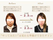 アロハ(ALOHA.)/“やりたい”は変わるの準備の印