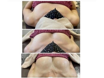 ロココ 豊田店(Rococo)/ビフォーアフター