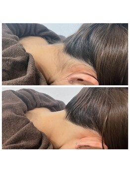 ミース 北九州店/うなじ△ビフォーアフター