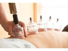 トーリ 代官山(taulli)/カッピング【代官山/鍼灸】