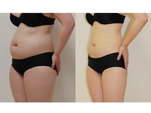 カブール 姫路店/インドエステお腹