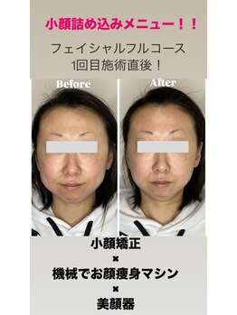 エミナル(EMINARU)/贅沢フェイシャルフルコース