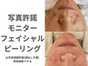 【フェイシャルモニター】肌質改善！ニキビ毛穴に！ハーブピーリング★¥11000