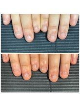 ウェルズユキ(well's yuki)/いつもギリギリで爪を切ってる