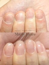 マリーロール 淀屋橋本店(Marie Laure)/自爪育成/深爪矯正/ネイルケア
