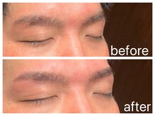 クラシックス(CLASSICS)/美眉wax脱毛