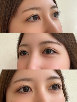 シューナランド(schoner Rand)/ラッシュリフト