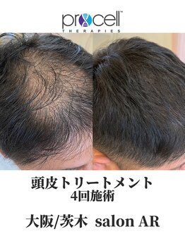サロン アール(salon AR)/【プロセルセラピーズ】