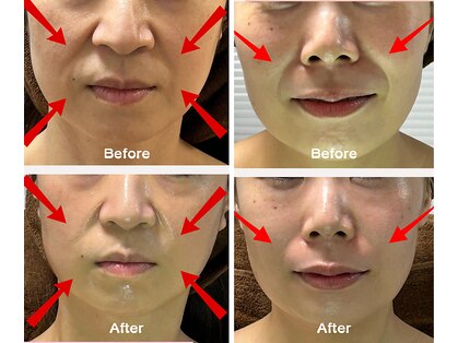 ユーフォリア(Euphoria)の写真