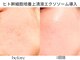 リジェネラティブセル メディカルサロン(Regenerative Cell Medical Salon)の写真/注目の日本初3種混合エクソソーム導入!毛穴・たるみ・シワ・シミ・乾燥へアプローチ◎土台から肌質改善!