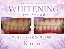 カノン 南熊本店(Kanon)/